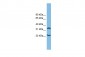 C6orf134 antibody - N-terminal region